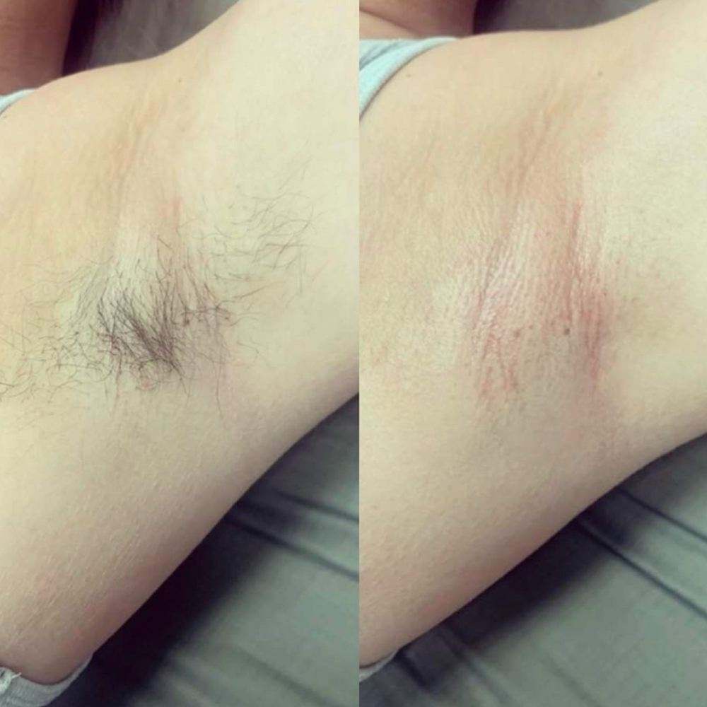 Armpit Wax at Starry Knight Beauty Bar in Terre Haute, IN