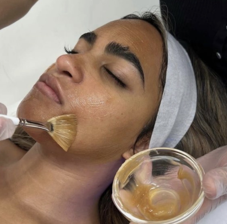 Advancedrenewal Peel