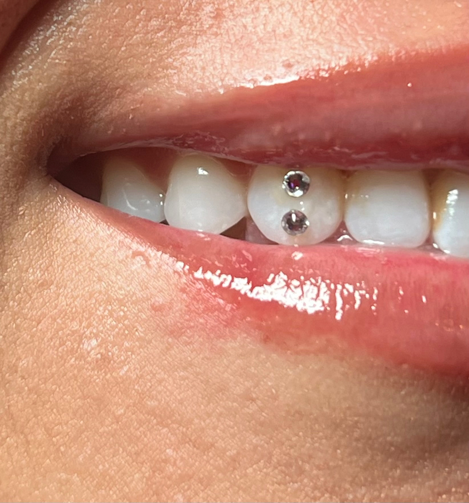 Single Tooth Gem Add On π