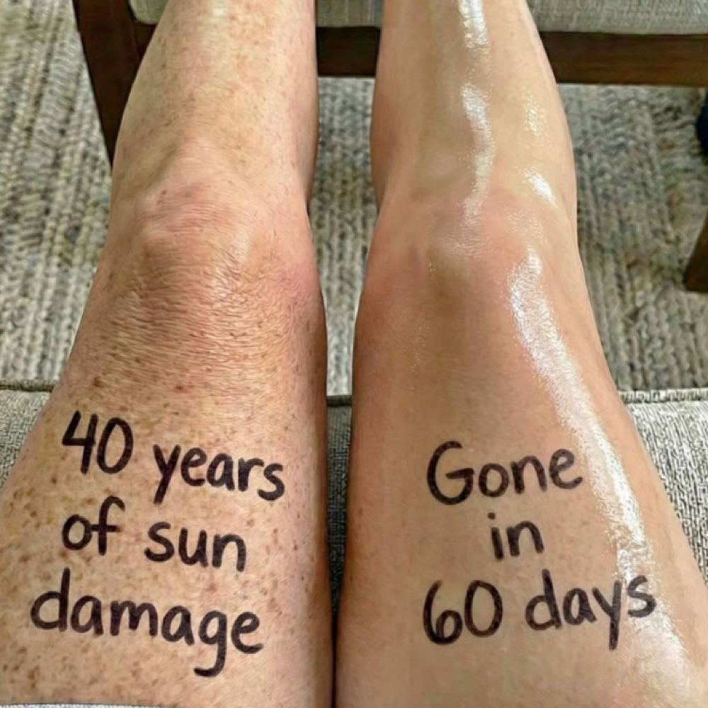 End Of Summer Body Peel Legs at Face to Face with Angela in Trinity, FL