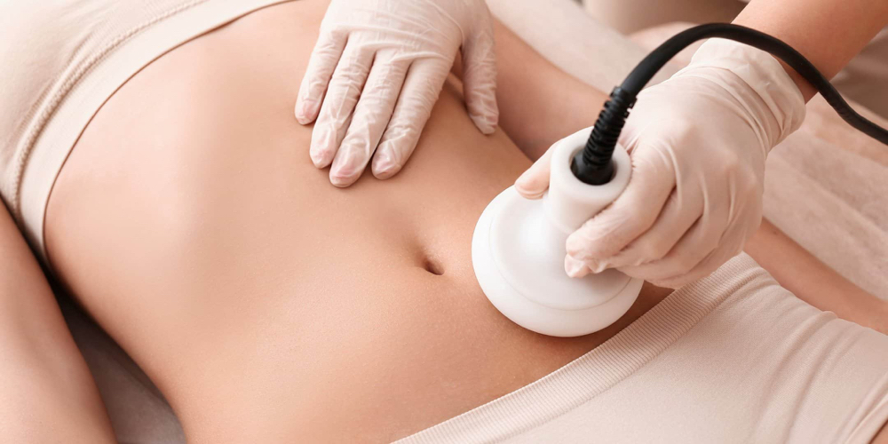 Ultrasound Cavitation