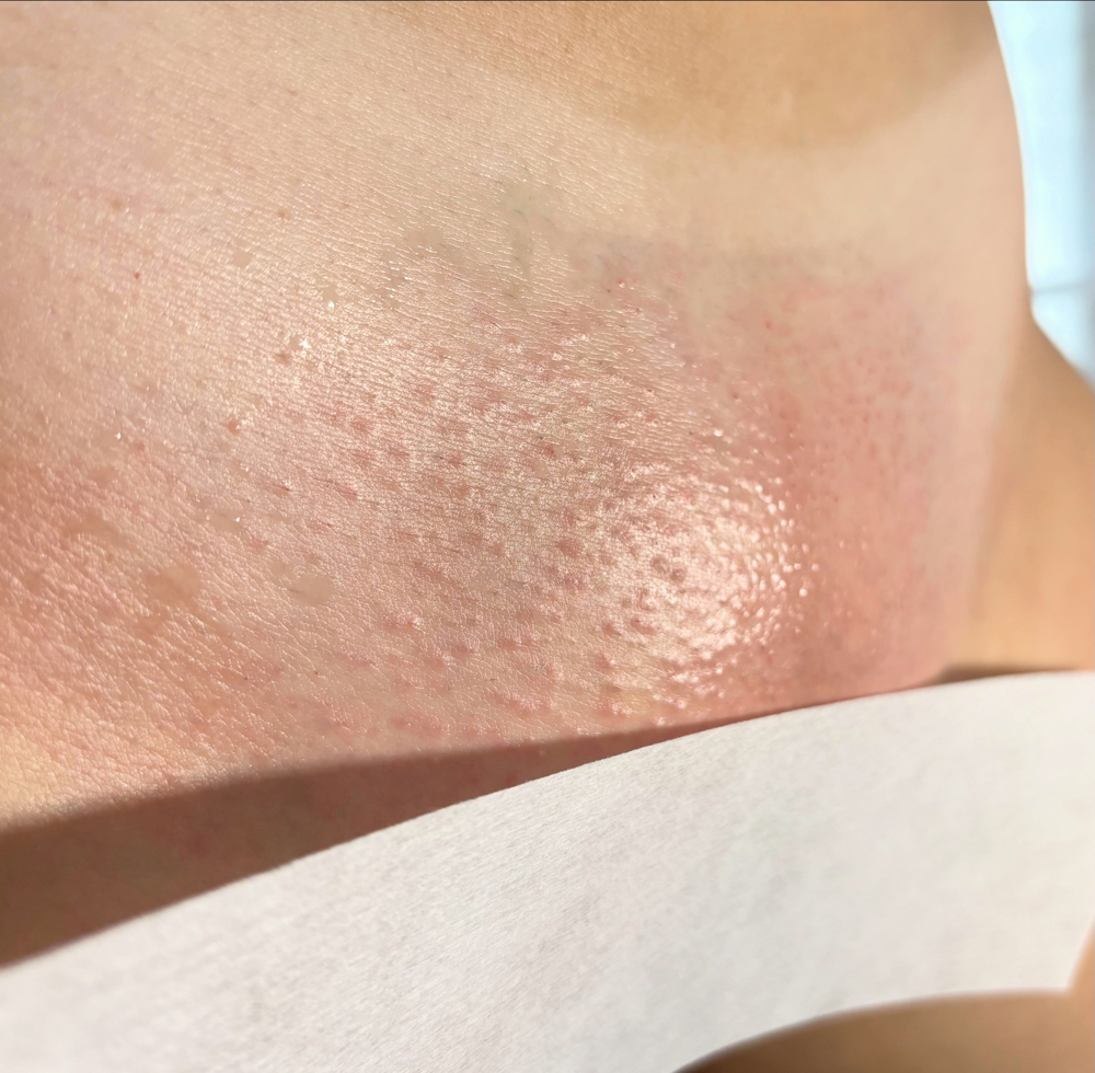 Brazilian Wax