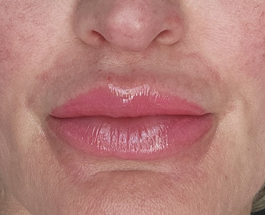 Lip Blushing