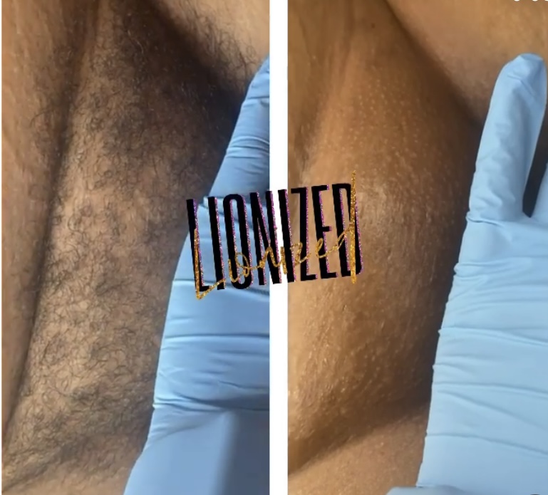 Full Brazilian at Lionized in Garfield Heights, OH