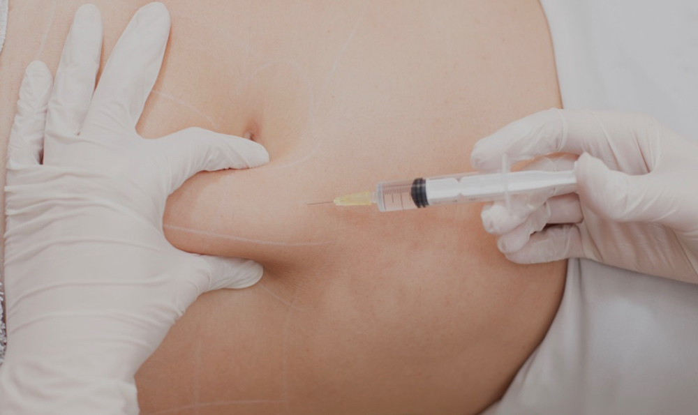 Lipo Dissolve Injections