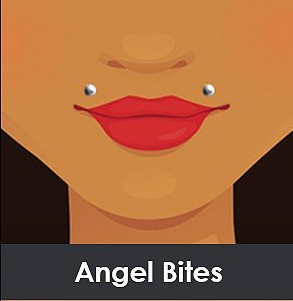 Angel Bites / Kiss