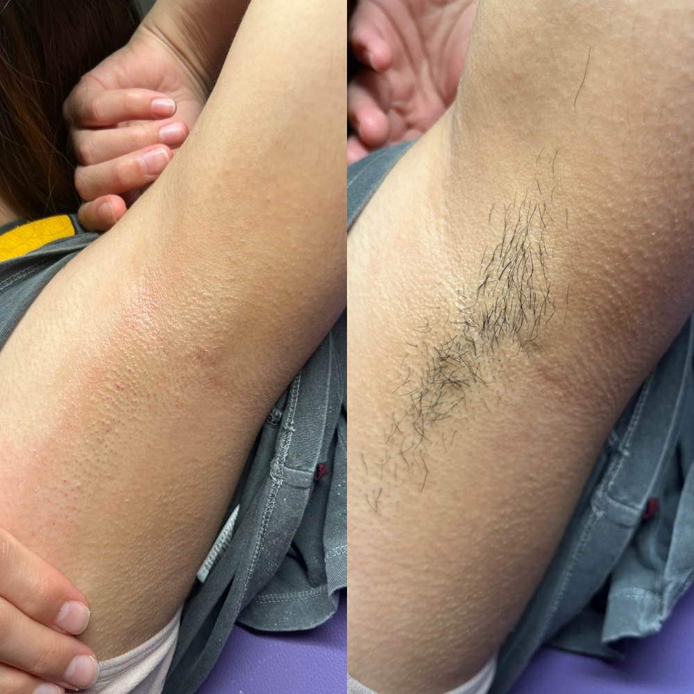 Underarm Wax at Of The Rose Esthetics in Fresno, CA