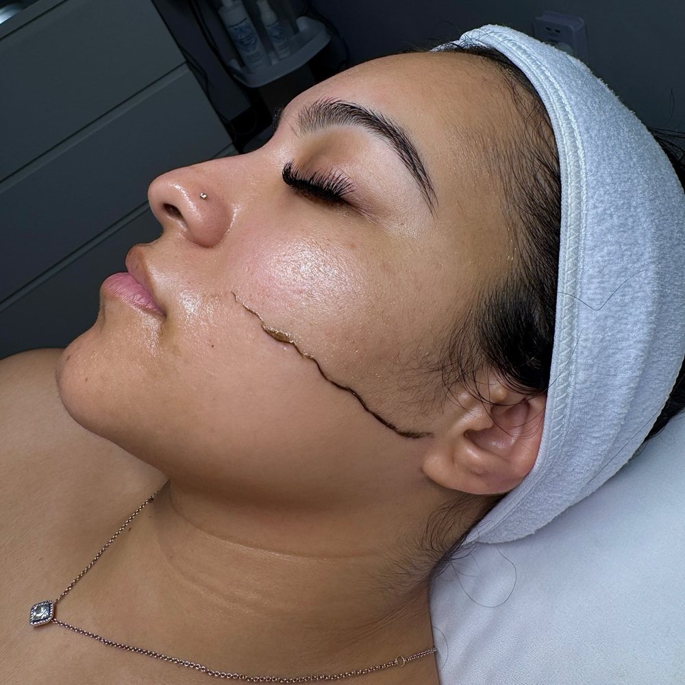 Dermaplane Glow Facial