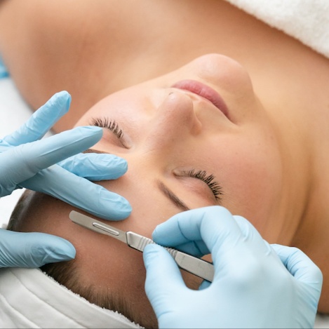 Express Dermaplane Facial at Skin & Glow Aesthetics by Kelsey in Walnut Creek, CA