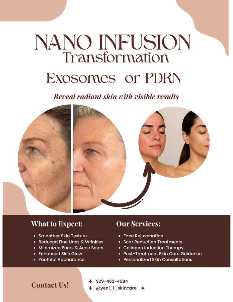 Nano Infusion Exosomes  Or PDRN