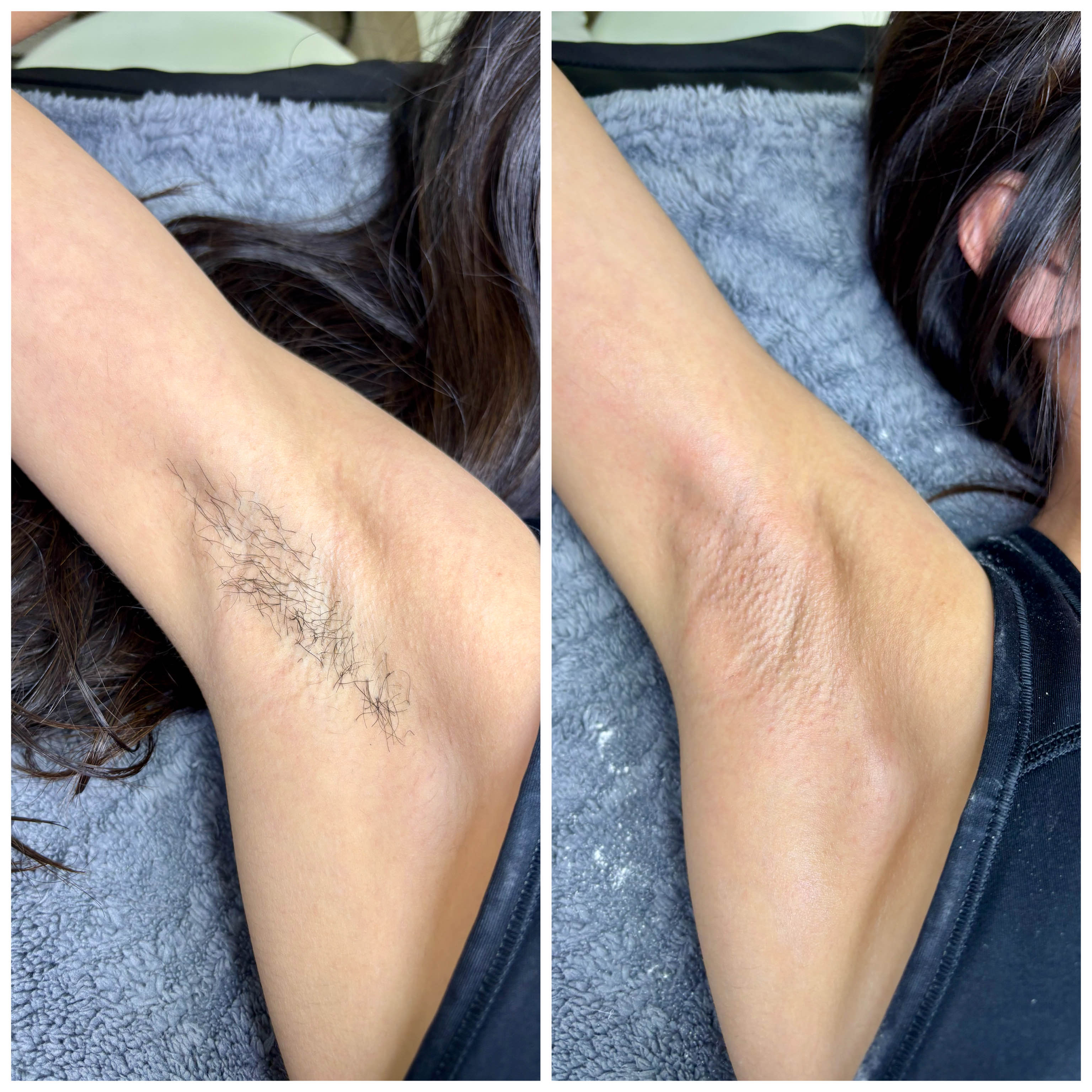 Underarm Wax