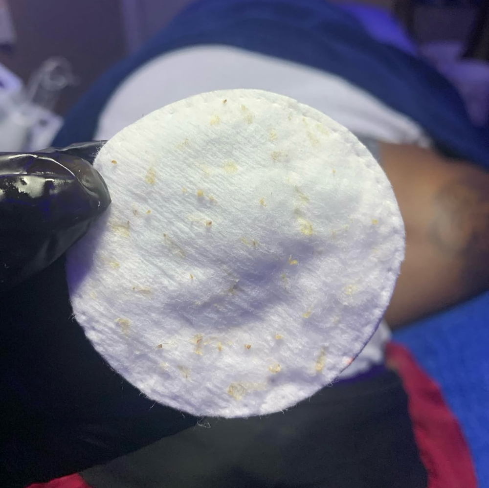 Deep Cleansing Facial. at Quinta Esthetics in Terrytown, LA