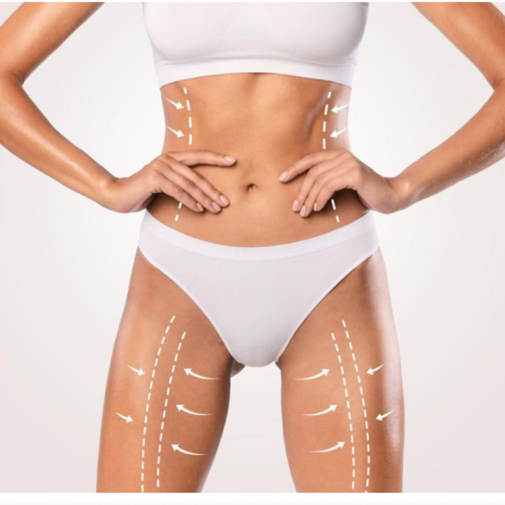 Body Contouring at Acnessia Laser Clinic in Guaynabo, PR