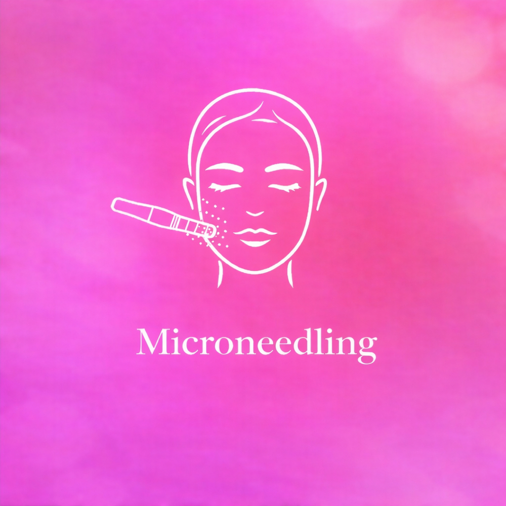 Full Face Microneedling at The Aesthetics Lounge in Cordova, TN