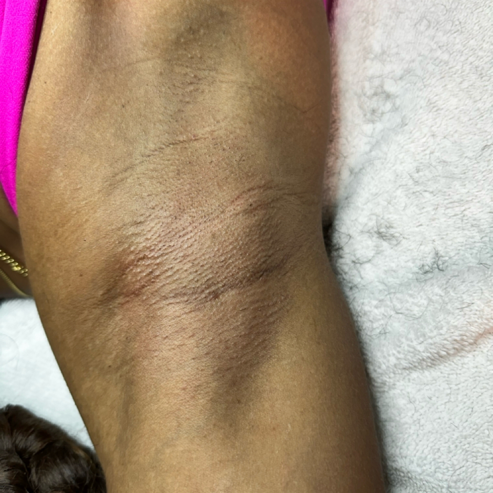 Under Arm Wax at Millennium Day Spa in Inglewood, CA