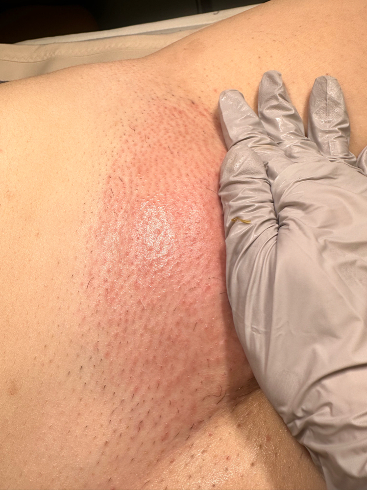Brazilian Wax