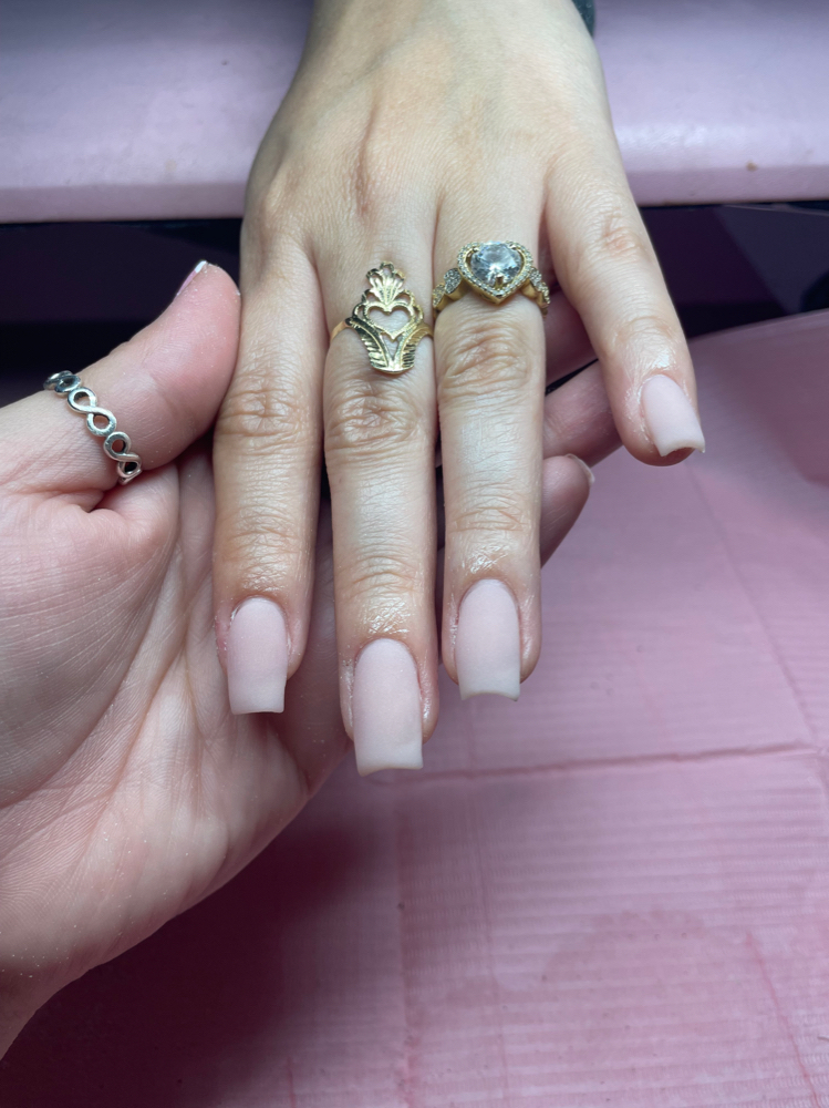 Overlay Set
