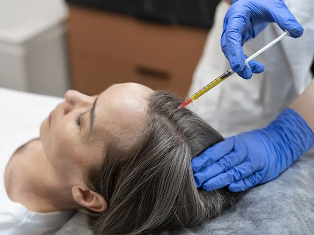 PRP Hair Loss Treatment