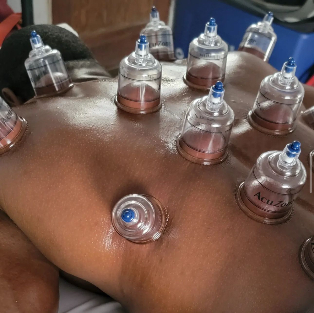 Cupping Massage