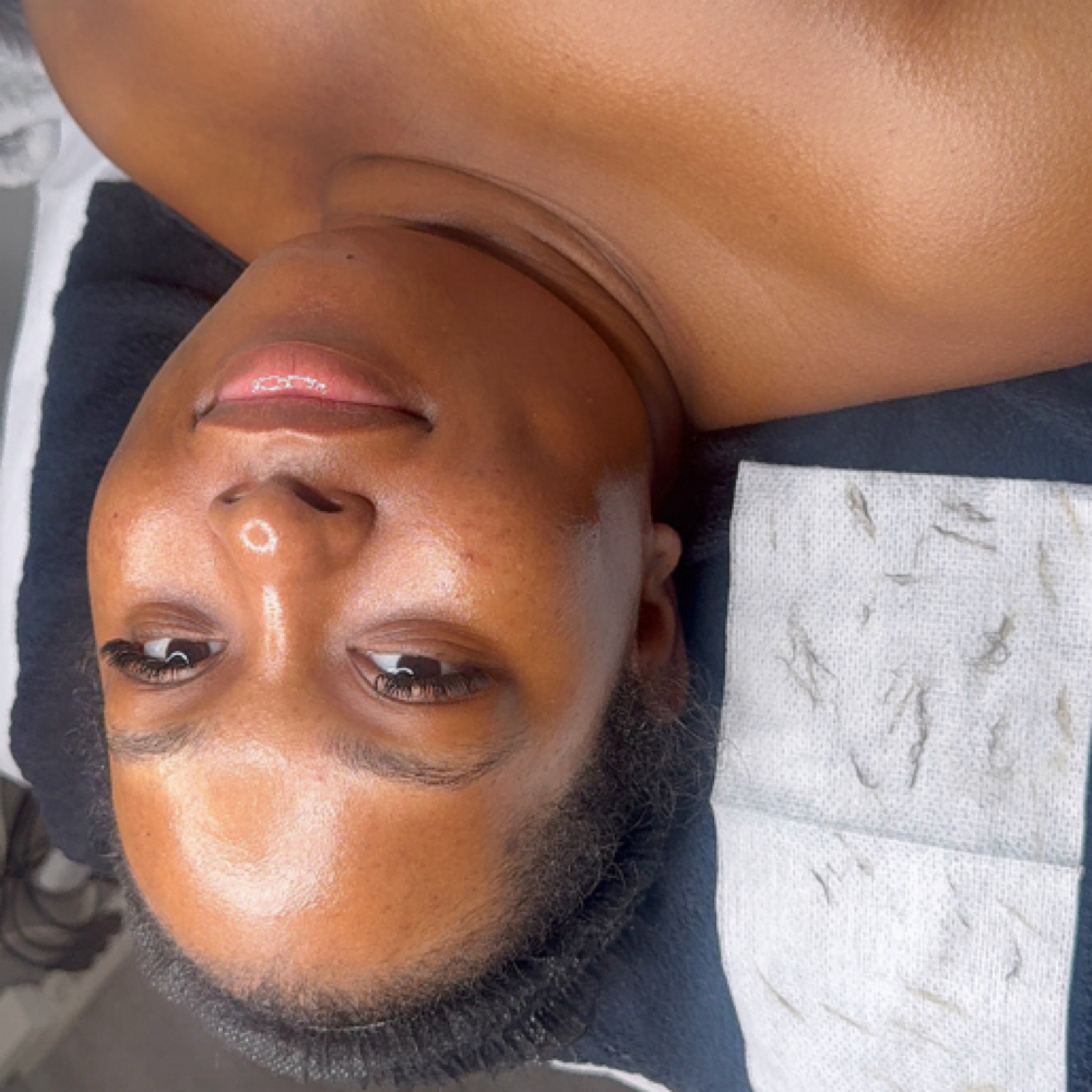 Derm-Planing at Skin Affair with C. Monae in Philadelphia, PA