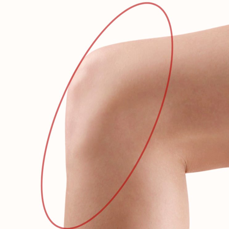 Knees at Bareline Aesthetics in Brea, CA