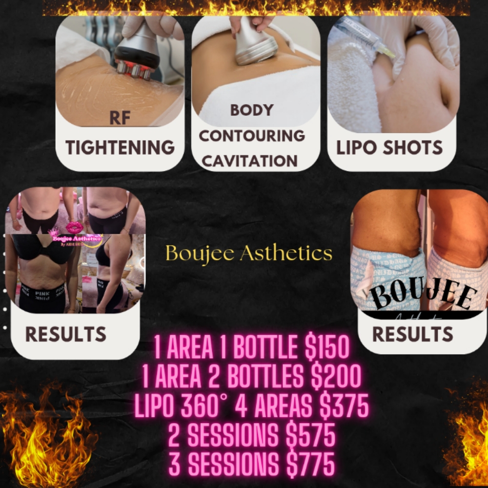 LIPO 360° at Boujee Asthetics ✨ in Tucson, AZ