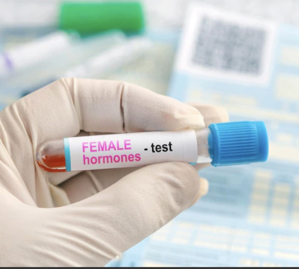 Hormone Lab Review at EDEN Aesthetics in New Port Richey, FL