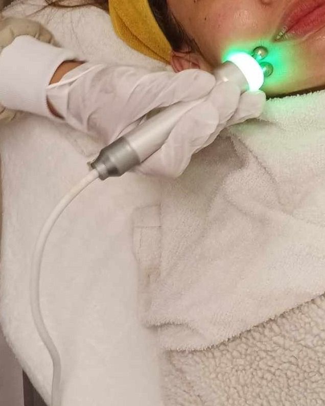 Microcurret Treatment