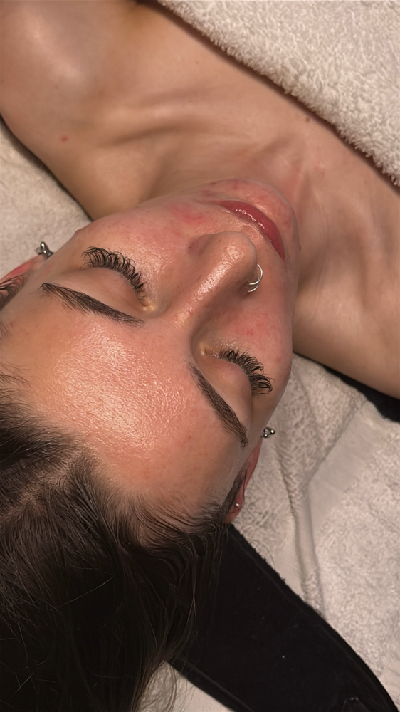 HydroFacial🫧