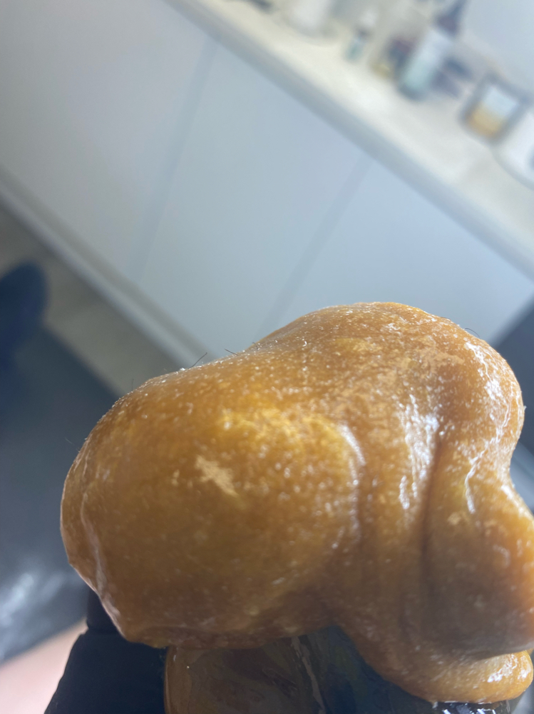 Underarm Sugaring