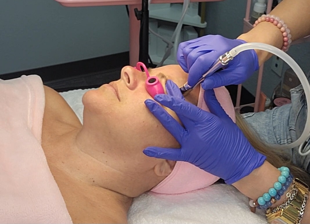 Diamond Dermabrasion Facial