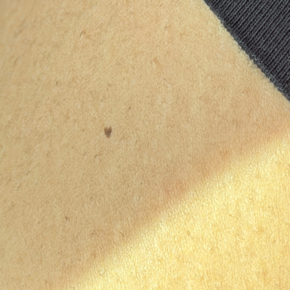 Beauty Mark at Hello Beautyyy in North Kansas City, MO