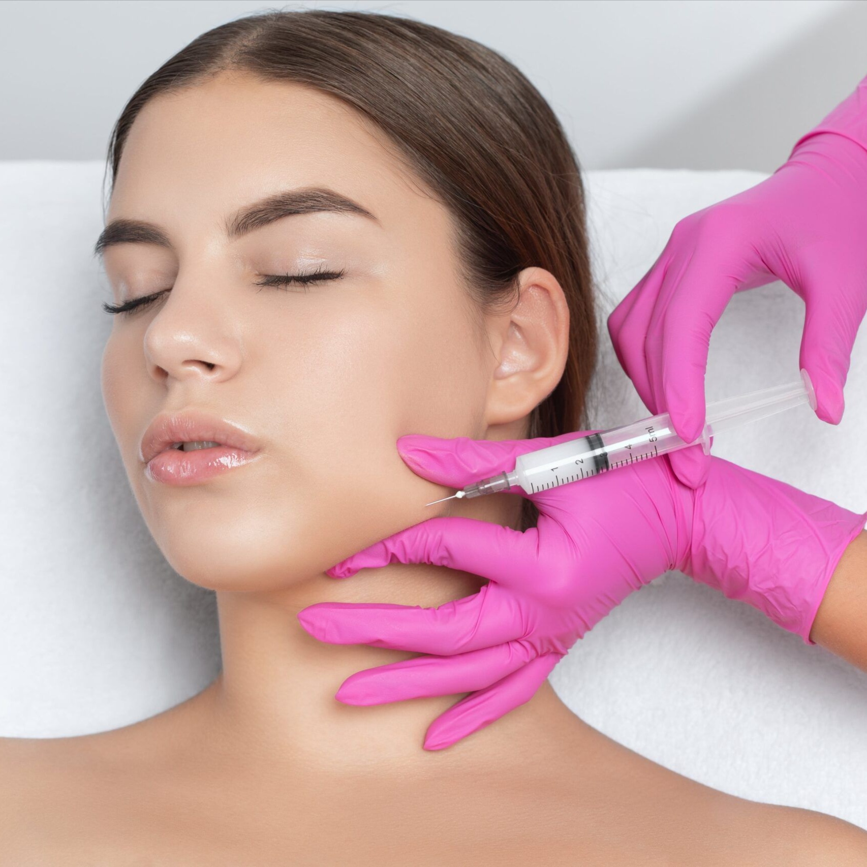 Radiesse (for Snatched Jawline) at E.V. Aesthetics in Torrance, CA