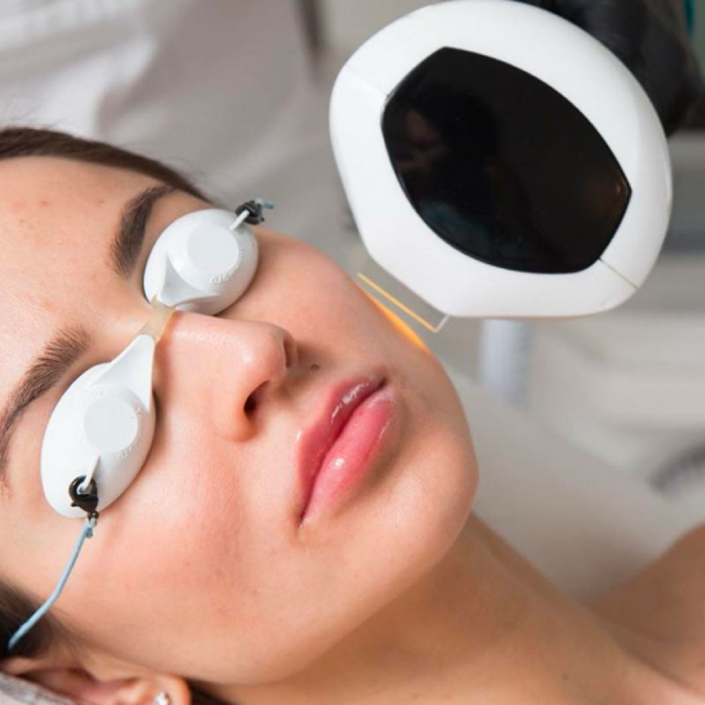 IPL Photo Facial | Redness at Empower Aesthetics in Canyon Lake, TX