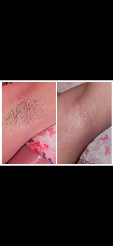 Underarm Wax