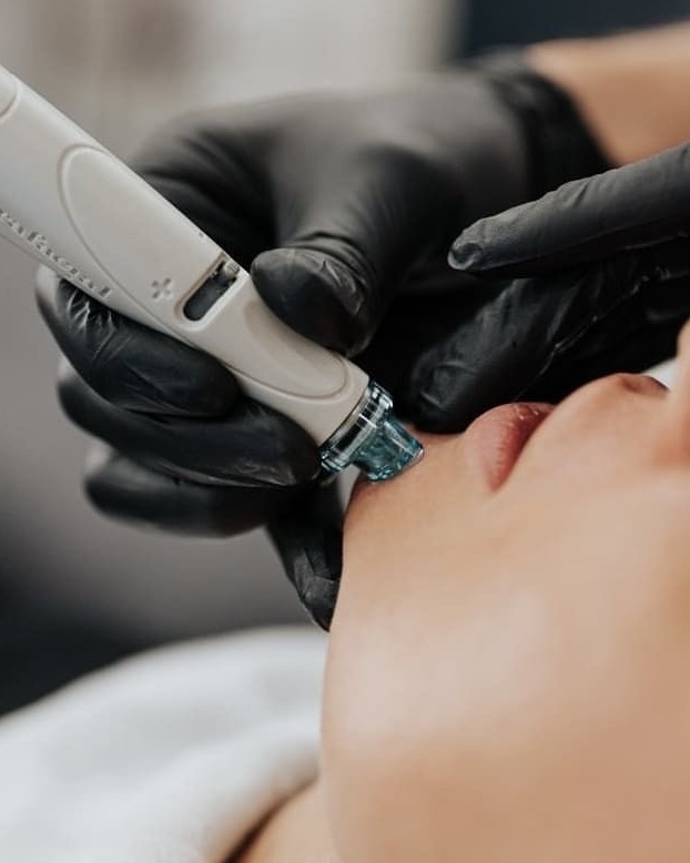 HydroGlow Facial- Hydrodermabrasion