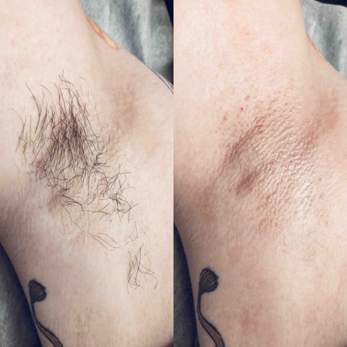 Underarm Wax