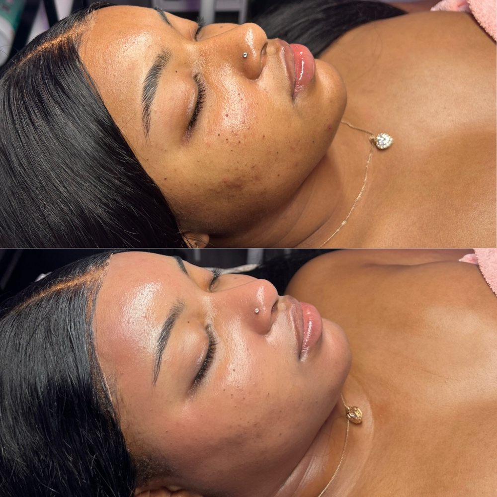 Korean Facial