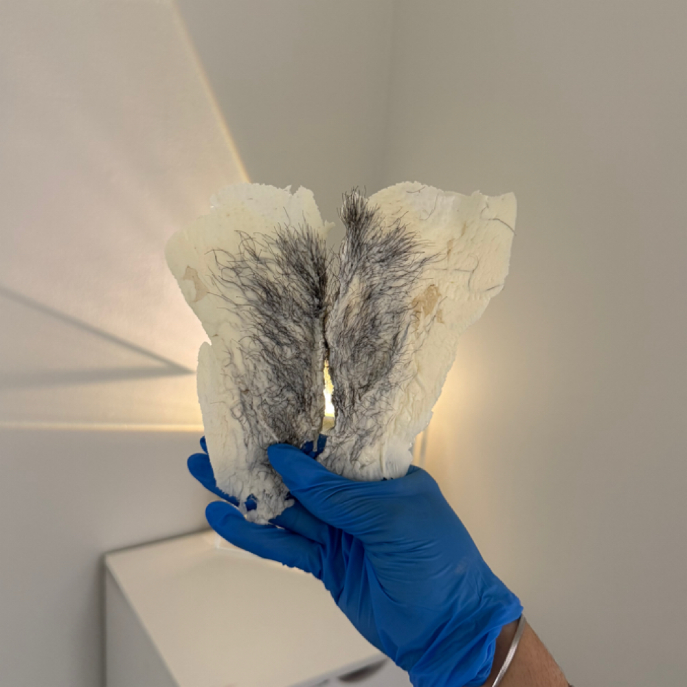 Bare Bloom Bundle at SKNFORM in Phoenix, AZ