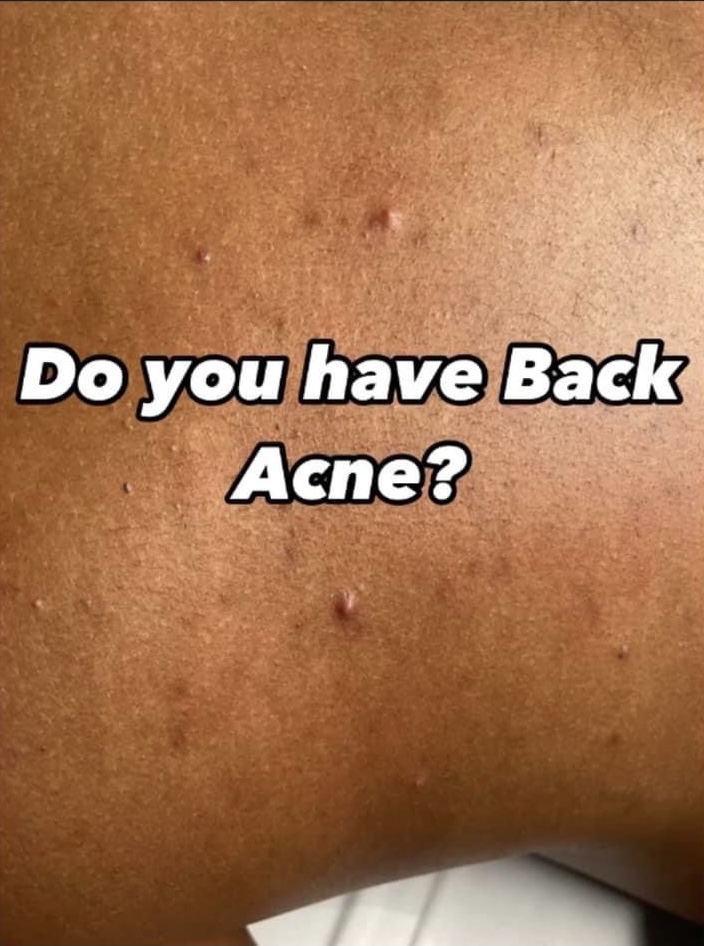 Back Facial