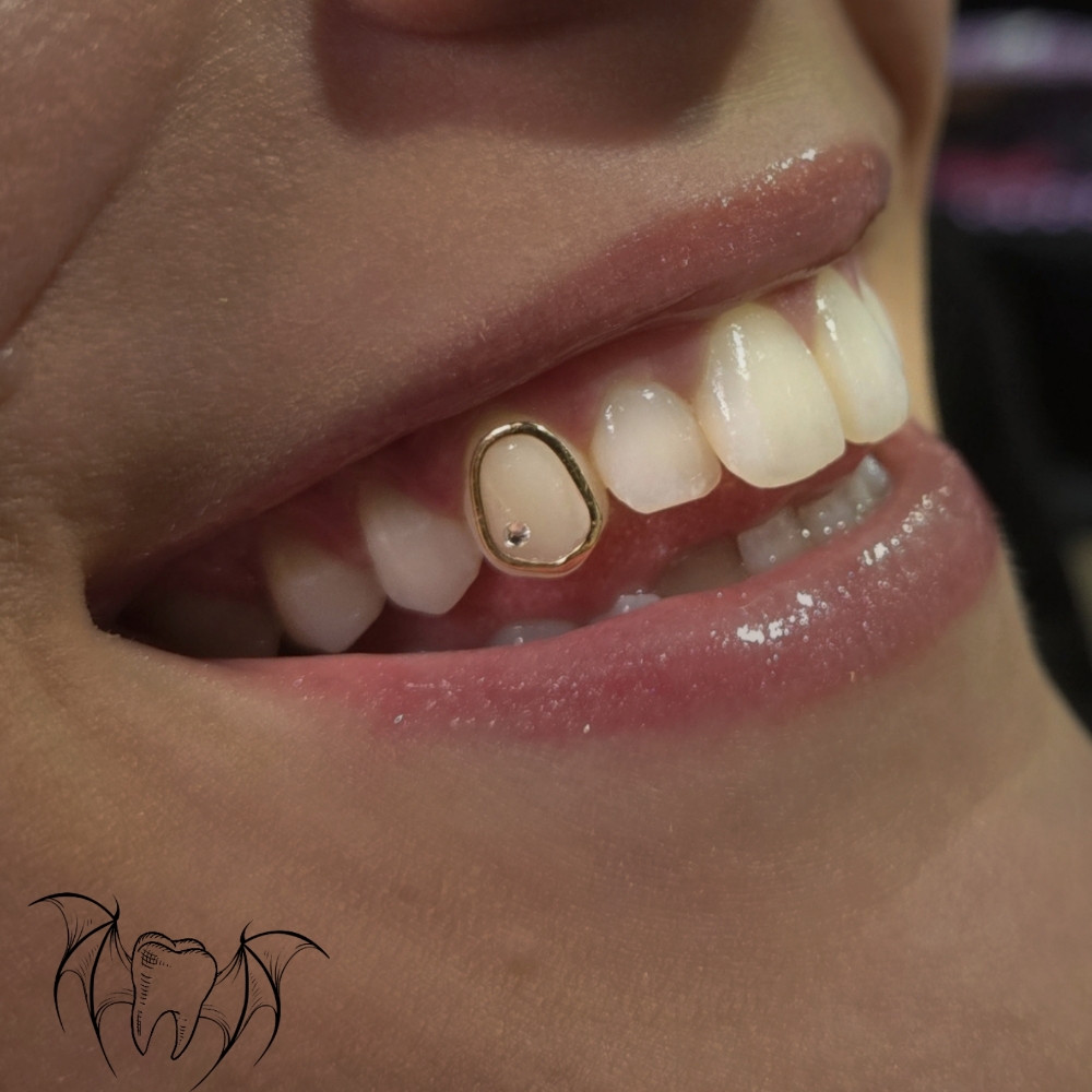 Tooth Gem