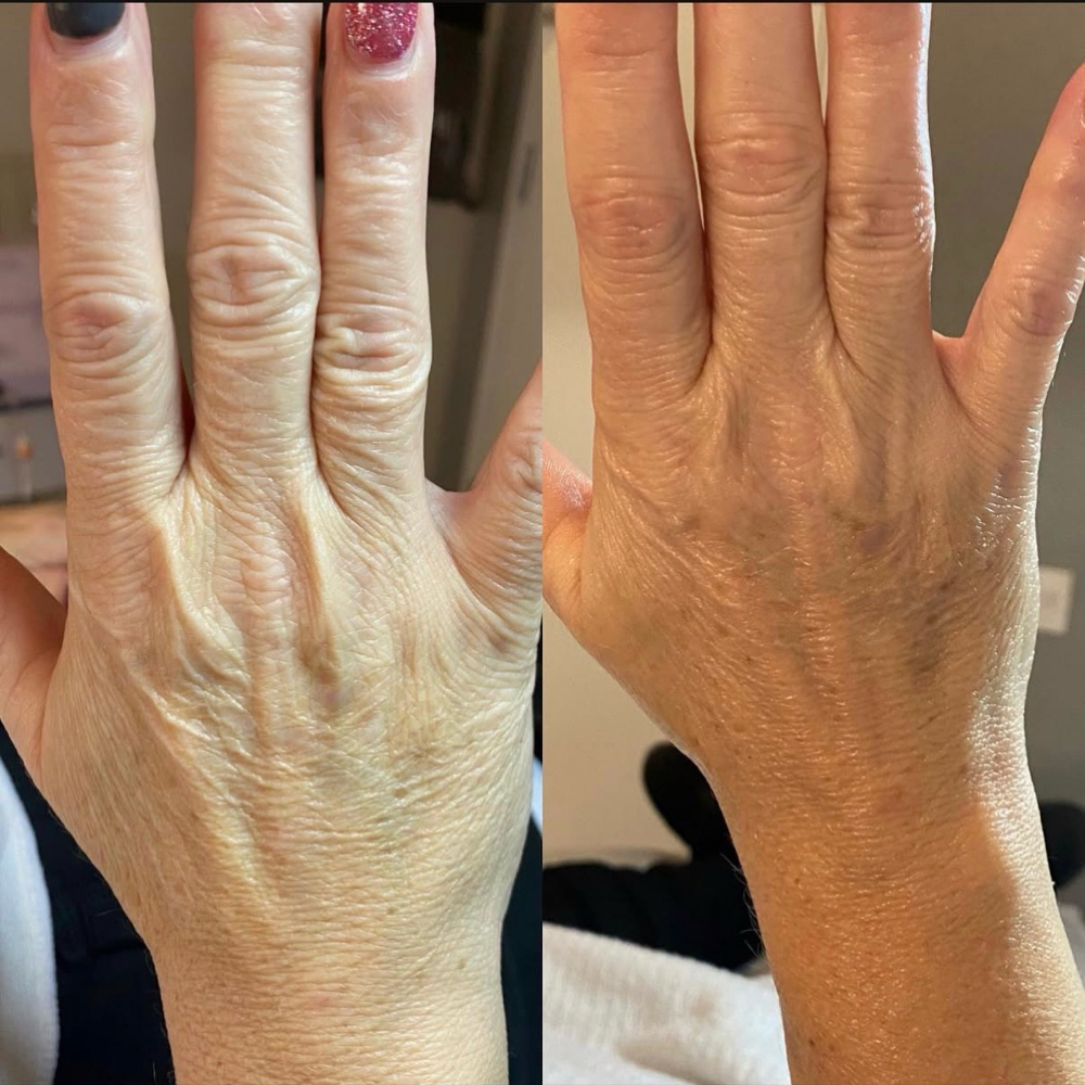 Paraffin Add-On at SKIN by Christine Russell in Green Bay, WI