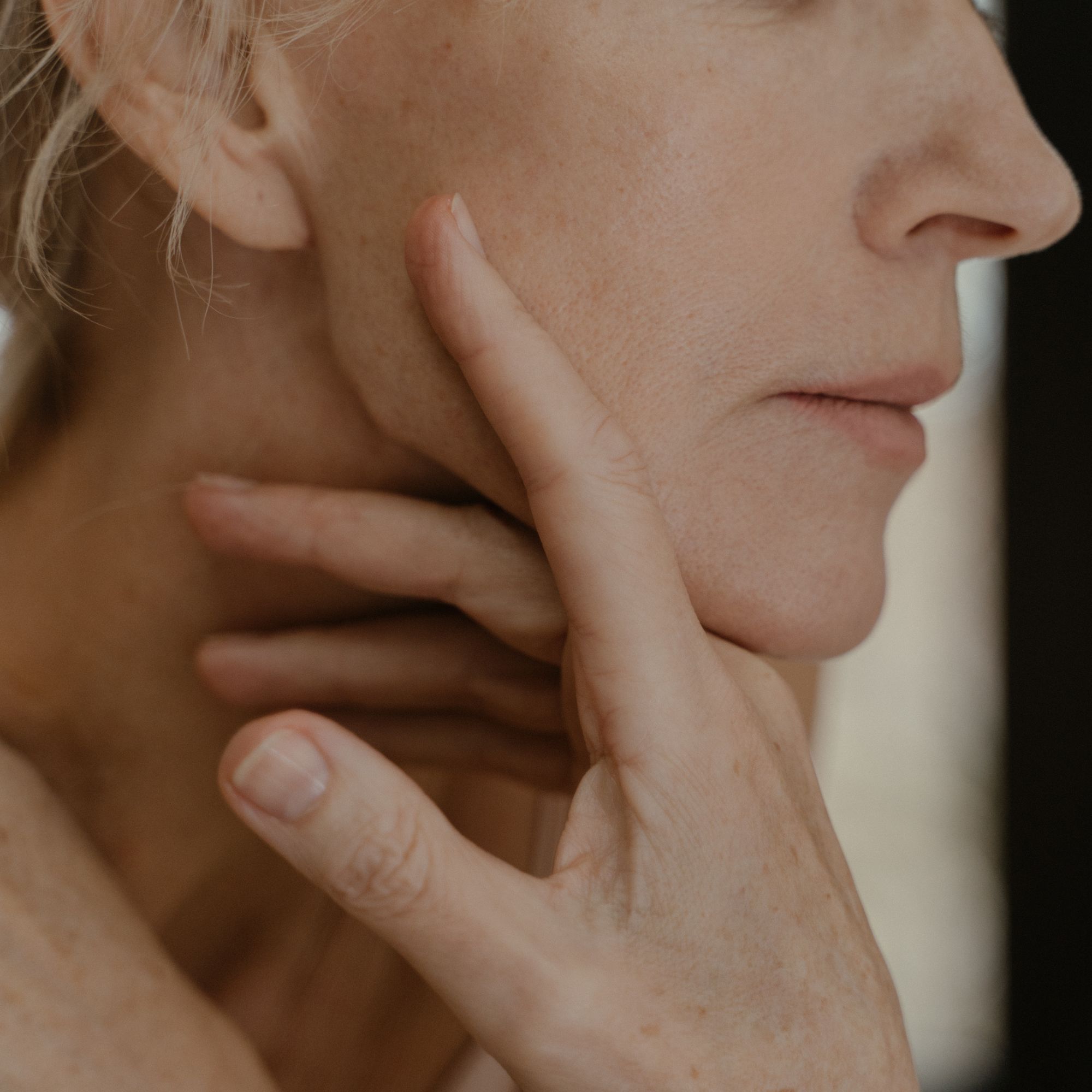 Skin Consultation