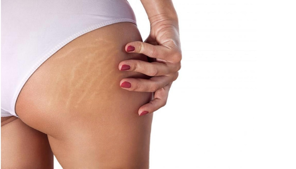 Microneedling For Body