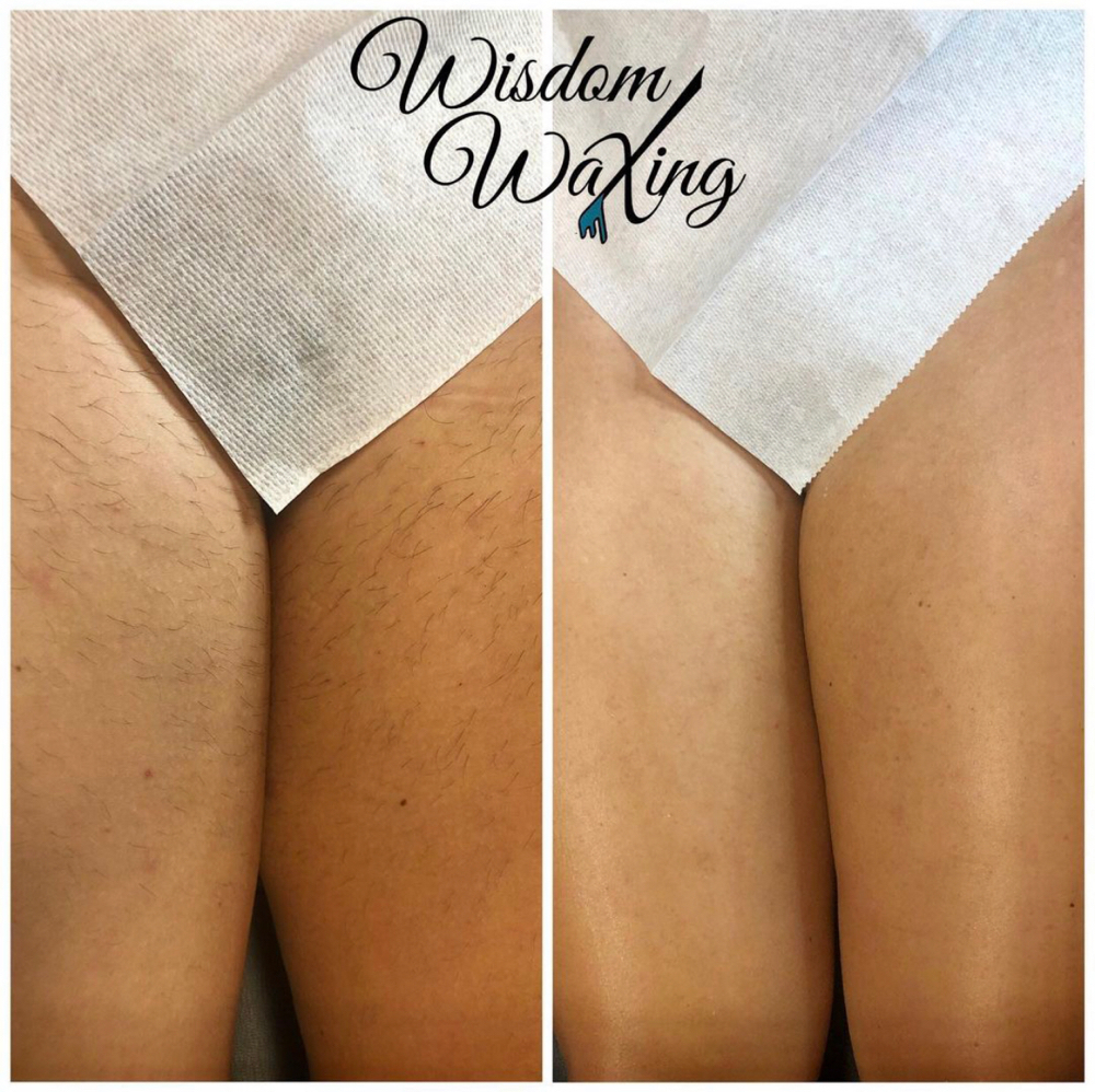 Inner Thigh Wax