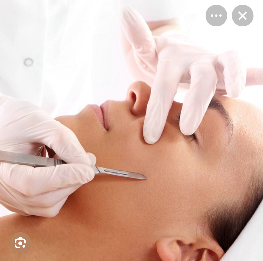 Dermaplaning with enzyme peel at Blooms & Beauty Esthetics INC in Orlando, FL