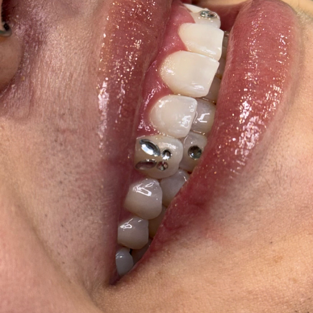 Small Tooth Gem Design Or Freestyle at JCR Piercings in Waukegan, IL