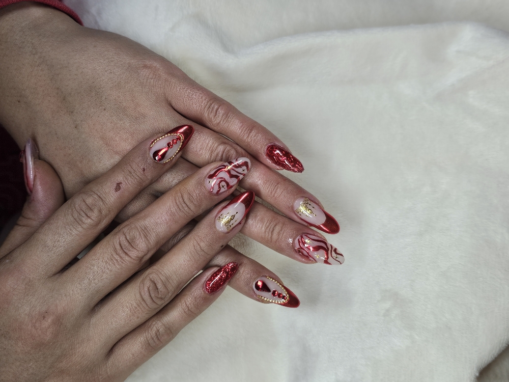 Structured Gel