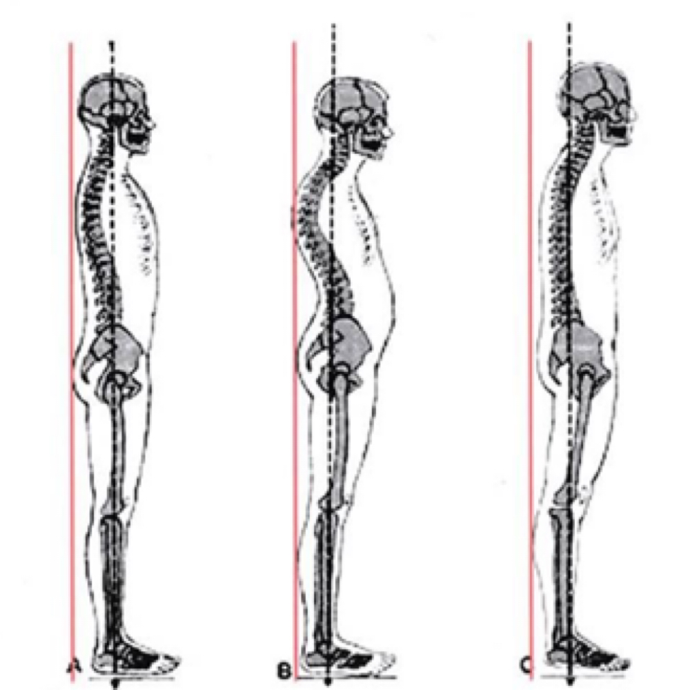 Postural Anaylsis at Rooted Alignment Massage Therapy in Colorado Springs, CO