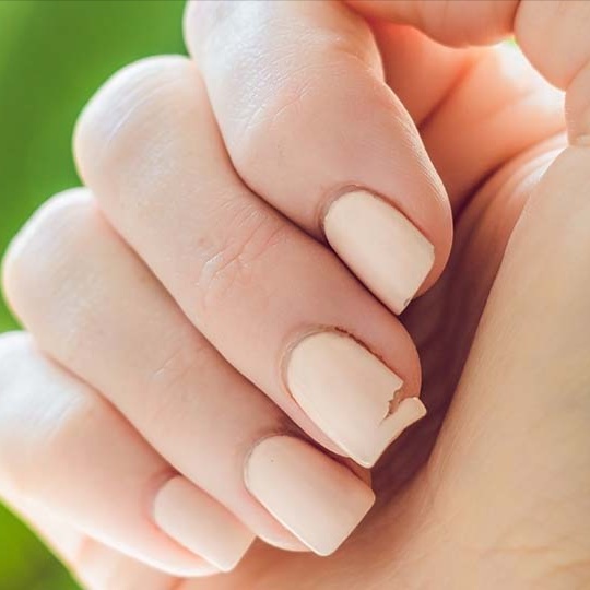 Nail Repair at Nail Pro-Filers in Cresthill, IL